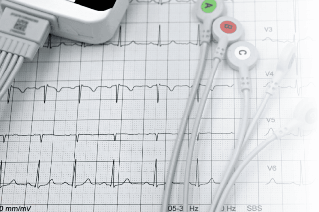 Blick auf medizinische Herzdaten